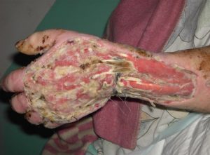 krokodil