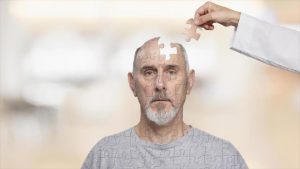 alzheimer