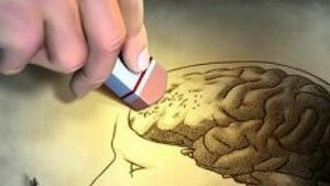 alzheimer