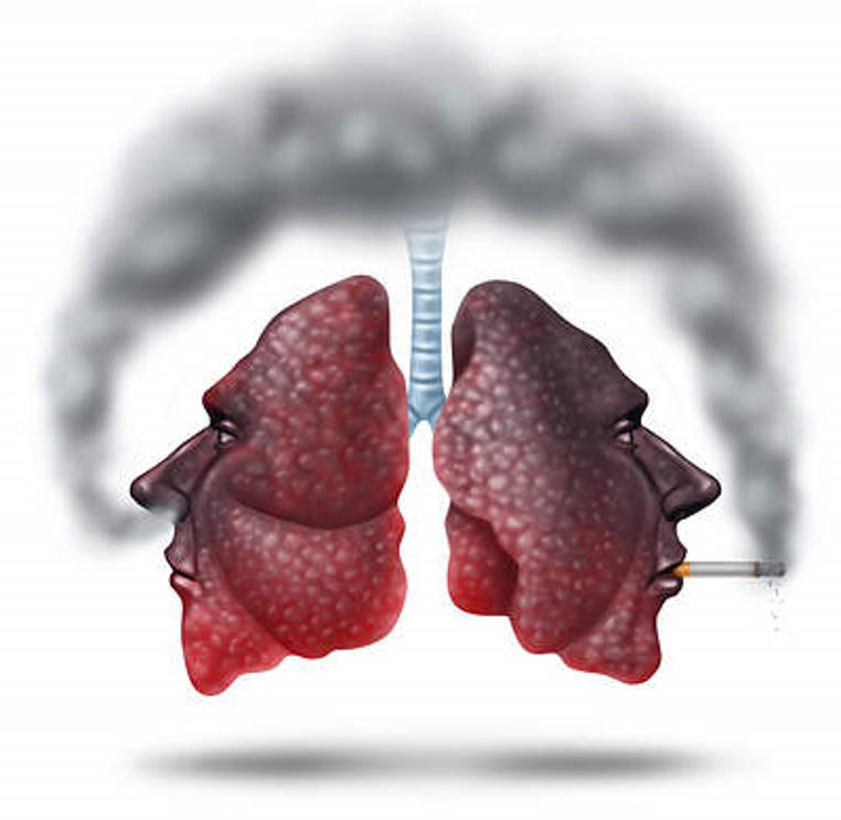 pulmones de un fumador